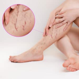 05 adobestock 299406272 cropped
