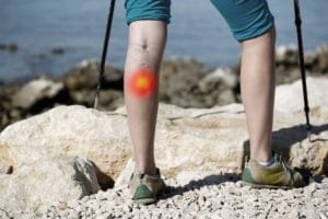 Woman with varicose veins on a leg walking using trekking poles. Red dot effect.
