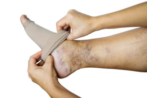 istock 1257404256