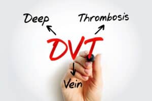 Diagram shows person with a marker annotating what the acronym DVT means: deep vein thrombosis