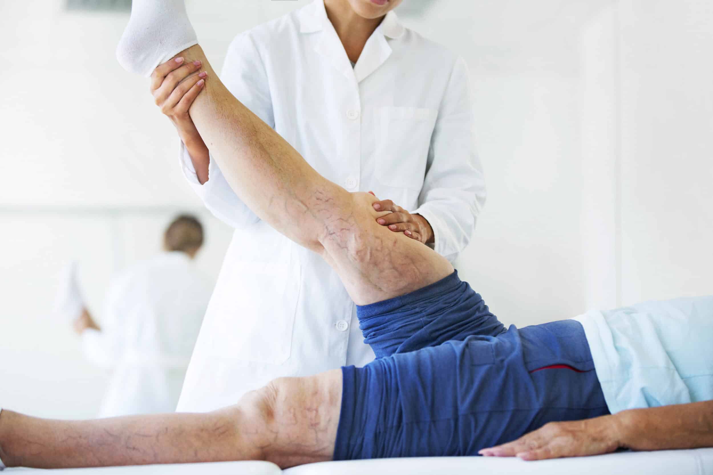 Man with varicose veins on legs seeing vein specialist for treatment.